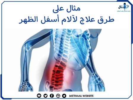 مثال على طرق علاج لآلام أسفل الظهر