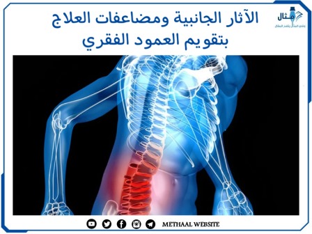 الآثار الجانبية ومضاعفات العلاج بتقويم العمود الفقري