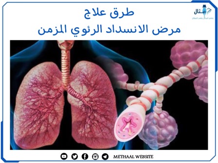 طرق علاج مرض الانسداد الرئوي المزمن