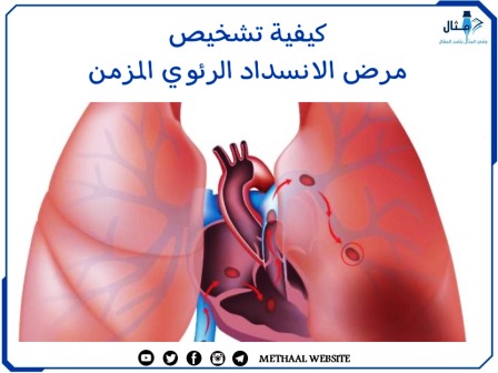 كيفية تشخيص مرض الانسداد الرئوي المزمن