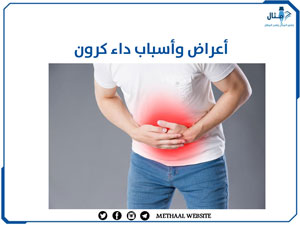 أعراض وأسباب داء كرون أعراض وأسباب داء كرون