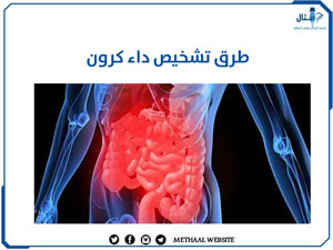 طرق تشخيص داء كرون طرق تشخيص داء كرون