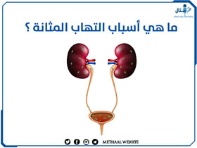 ما هي أسباب التهاب المثانة؟ ما هي أسباب التهاب المثانة؟