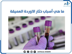 ما هي أسباب خثار الاوردة العميقة وطرق التشخيص؟ ما هي أسباب خثار الاوردة العميقة وطرق التشخيص؟