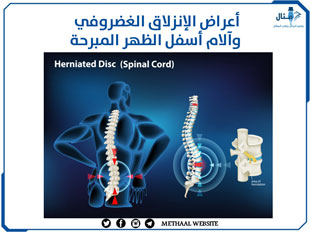 أعراض الإنزلاق الغضروفي وآلام أسفل الظهر المبرحة أعراض الإنزلاق الغضروفي وآلام أسفل الظهر المبرحة