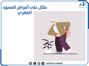 مثال على أمراض العمود الفقري