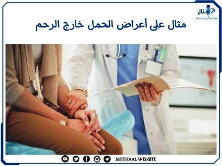 مثال على أعراض الحمل خارج الرحم