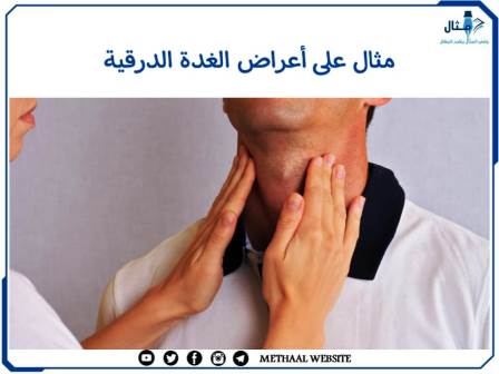 مثال على أعراض الغدة الدرقية